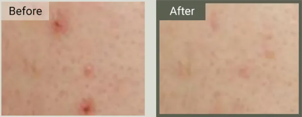 Crème mucine d'escargot 88% et Peptide