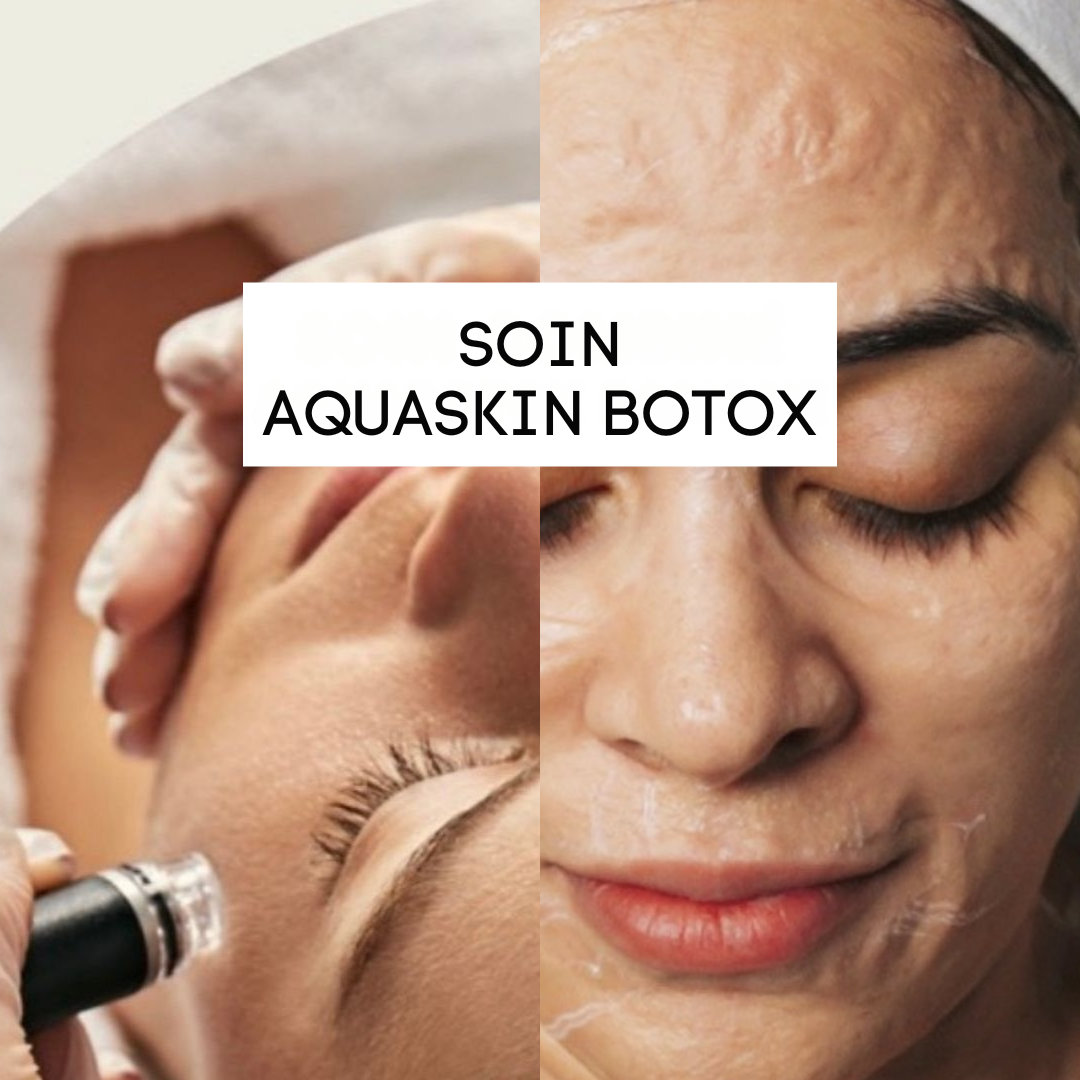 Soin combiné Aquaskin Botox 135€