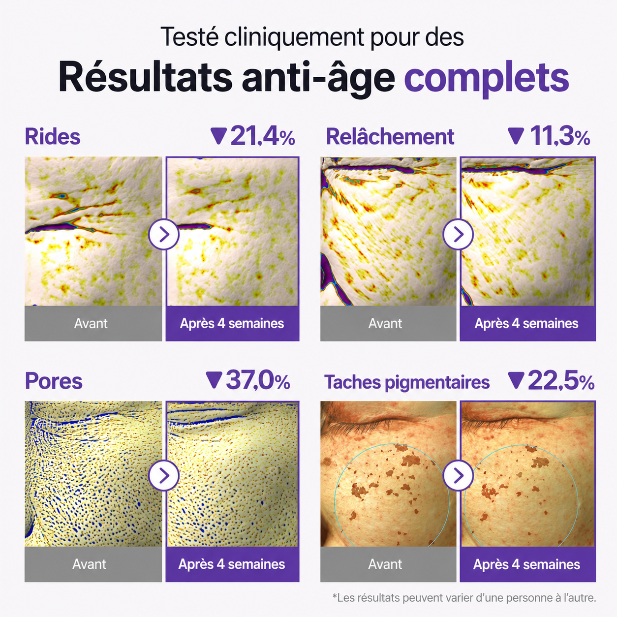 Contour des yeux NAD+ Rétinal Volumetox