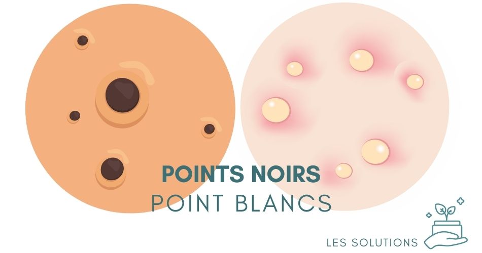 Solutions Points Noirs / Points Blancs