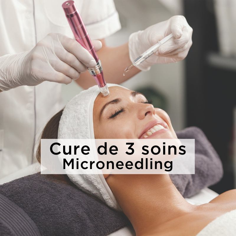 Cure de 3 séances Microneedling