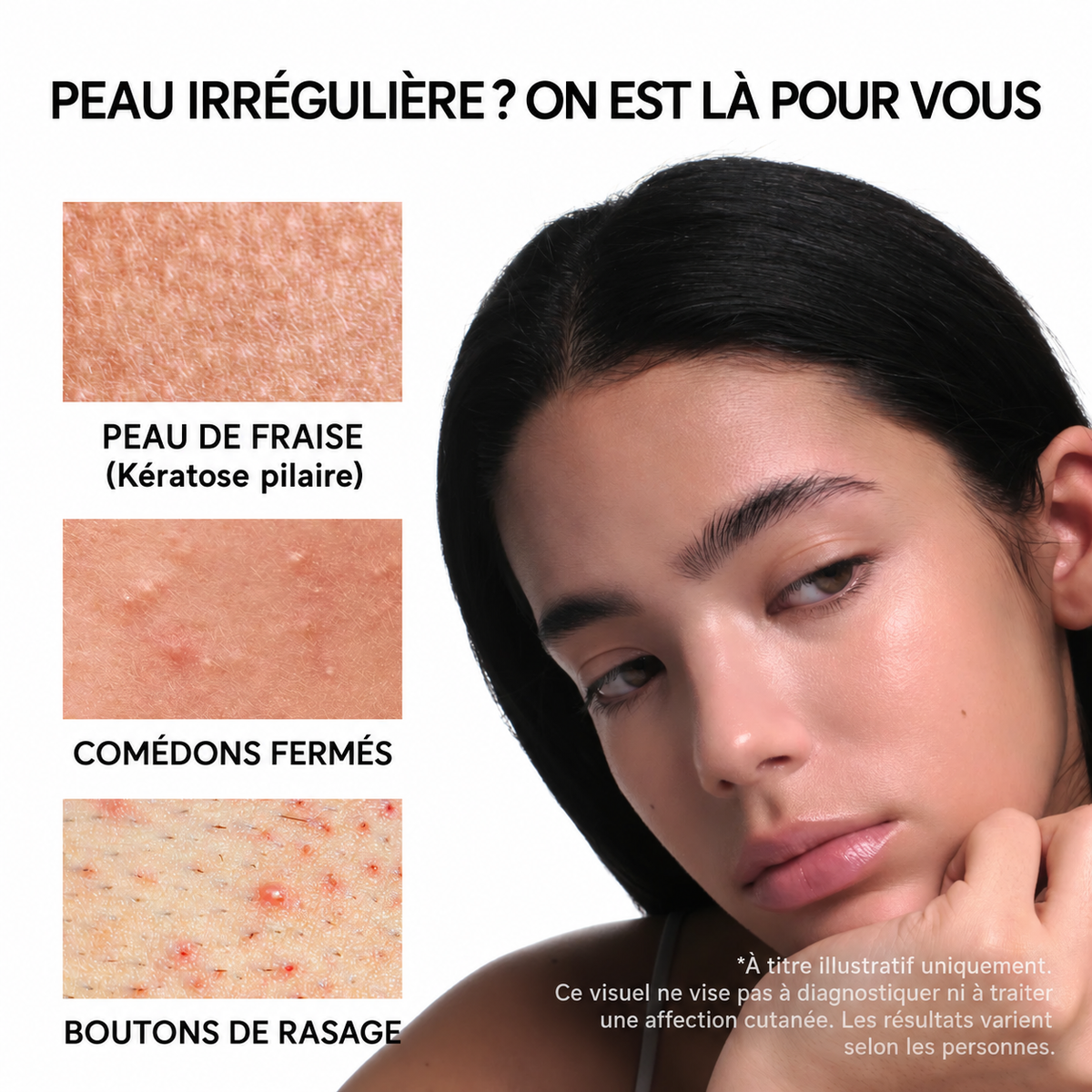 Eraser Shot Booster à l'acide Glycolique
