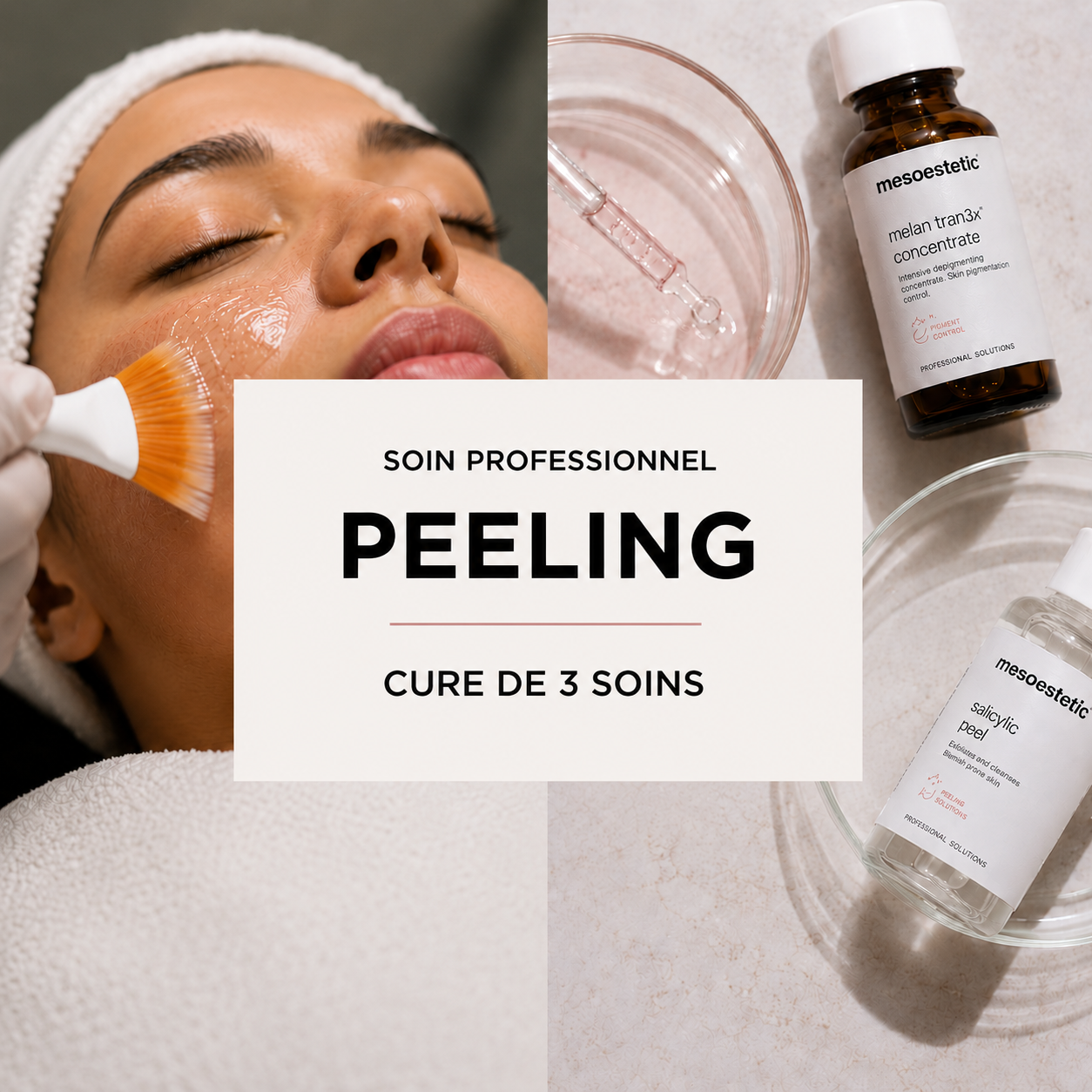 Cure de 3 séances Peeling Professionnel