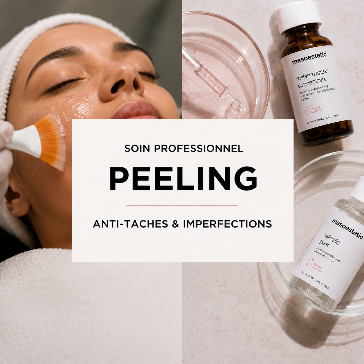 Peeling Professionnel 85€ (acompte 40€)